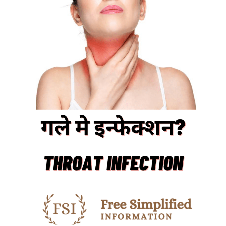 गले में इन्फेक्शन ? Throat infection