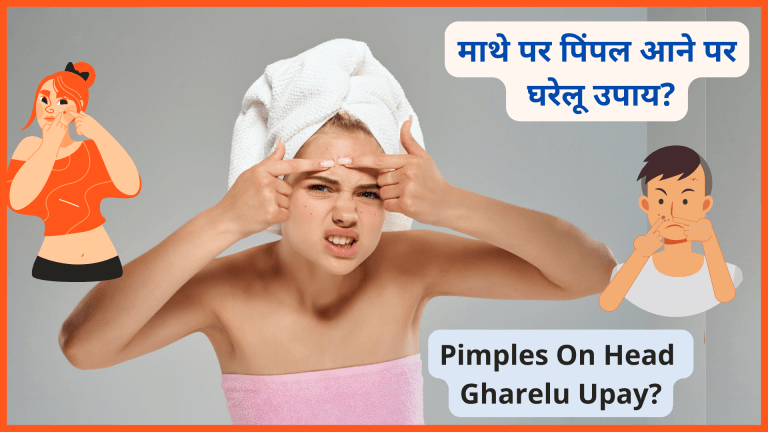 माथे पर पिंपल आने पर घरेलू उपाय ​Pimples par gharelu upay