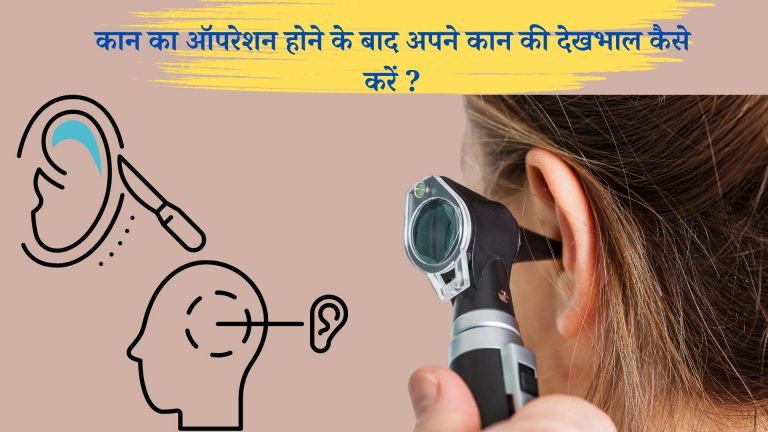 कान का ऑपरेशन होने के बाद अपने कान की देखभाल कैसे करें :-